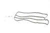 Прокладка кришки клапанної FORD 1.25/1.6 16V ZETEC FUJA/HWDA/HWDB (КЛАП. КР-ПЛАСТИК) (вир-во Elring) ELRING 761.031 (фото 1)