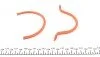 Комплект прокладок (нижній) Renault Kangoo/Clio/Megane 1.4/1.6 88- (opt-om) ELRING 867.520 (фото 5)