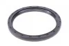 Комплект ланцюга ГРМ BMW 3 (E93/F30)/X3 (F25)/X5 (F15) 06-18 (z=86/70) (N47/B47) (opt-om) FEBI BILSTEIN 102040 (фото 11)