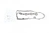 Прокладка кришки головки OPEL (вир-во Fischer) Fischer Automotive One (FA1) EP1200-917 (фото 1)