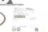 Трос ручника (задній) Audi A4 03-09 (1770/1600mm) (opt-om) LINEX 03.01.59 (фото 5)