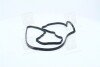 Прокладка крышки клапанной HYUNDAI D4BA/D4BB/D4BF (выр-во) PARTS-MALL P1G-A037 (фото 2)
